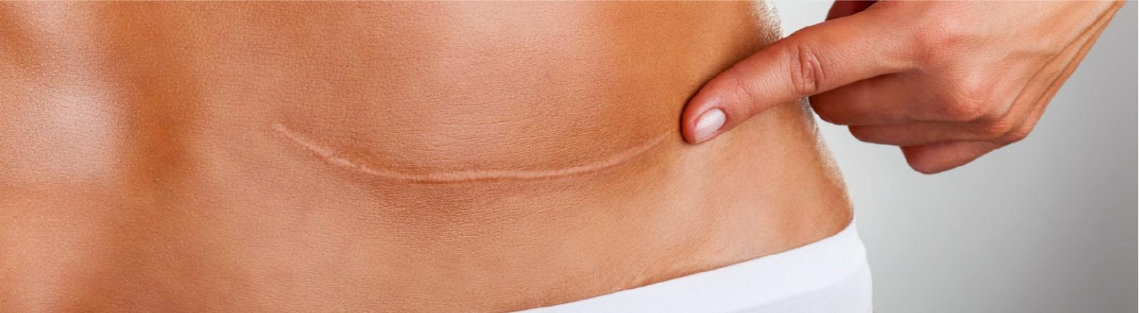 JORNADA ESPECIAL DE FORMACIÓN EN FISIOTERAPIA DERMATOFUNCIONAL